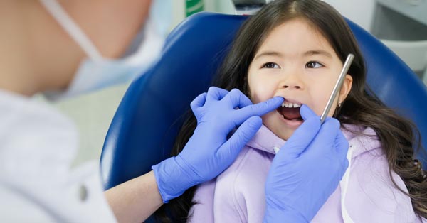 Cavities: How and Why Do Dentists Fix Cavities for Children?