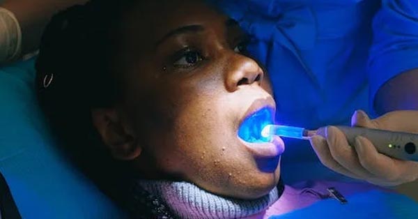 Choosing the Right Professional Teeth Whitening Treatment Choosing the Right Professional Teeth Whitening Treatment