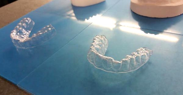 College Student Made His Own Braces For $60, And His Teeth Look Fantastic College Student Made His Own Braces For $60, And His Teeth Look Fantastic
