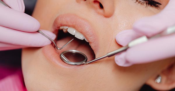 What Are the Most Common Dental Problems?