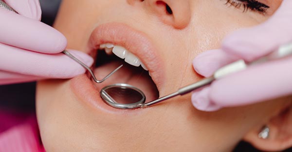What Are the Most Common Dental Problems? What Are the Most Common Dental Problems?
