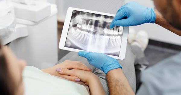 Complications During and After Surgical Removal of Third Molars