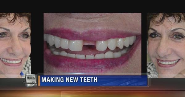Dentists Use Computers to Make Dental Implants