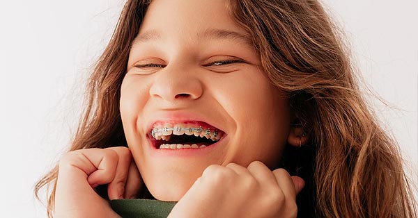 DIY braces? Orthodontists say to think twice before straightening your teeth solo DIY braces? Orthodontists say to think twice before straightening your teeth solo