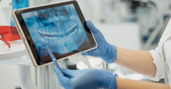 Explaining Each Part of Your Wisdom Tooth Surgery Bill Explaining Each Part of Your Wisdom Tooth Surgery Bill