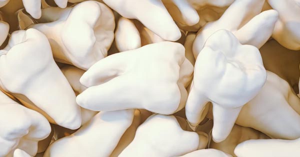 How long does it take to recover from a wisdom tooth extraction? How long does it take to recover from a wisdom tooth extraction?