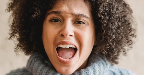 Mystery Solved: The Story on Canker Sores Mystery Solved: The Story on Canker Sores