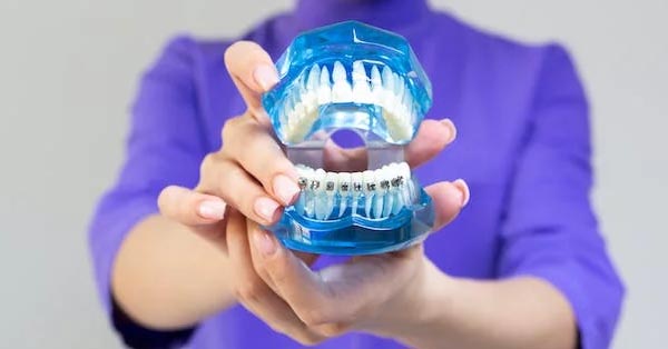New material used in molar extraction sites optimizes bone regeneration and dental implant stability New material used in molar extraction sites optimizes bone regeneration and dental implant stability
