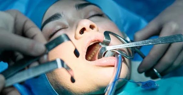 What Is Oral Surgery and How Is It Used? What Is Oral Surgery and How Is It Used?