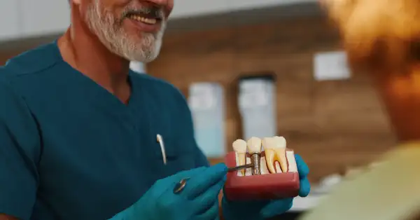 Helpful dental information about Dental Implants Washington