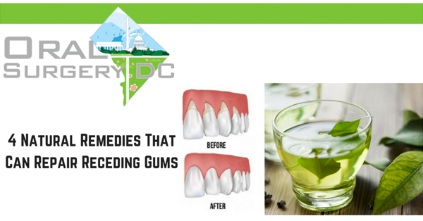 These 4 Natural Remedies Will Repair Receding Gums These 4 Natural Remedies Will Repair Receding Gums