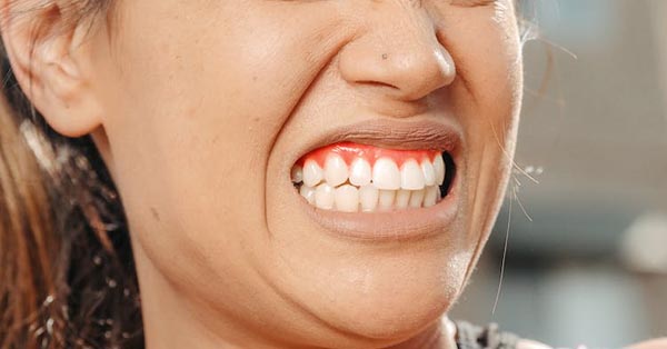 What can cause gum pain?
