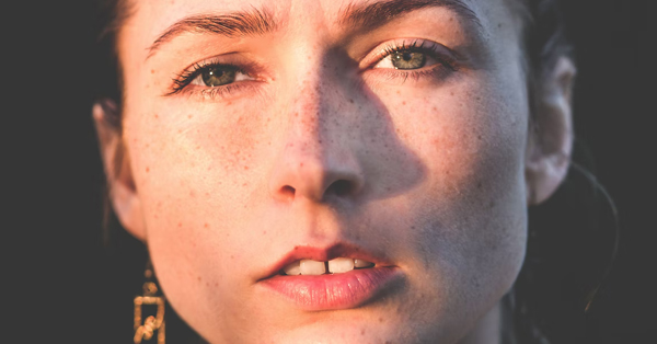 What is Diastema? What is Diastema?