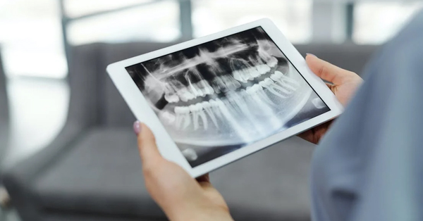 When and Why Your Dentist Will Refer You to an Oral Surgeon When and Why Your Dentist Will Refer You to an Oral Surgeon